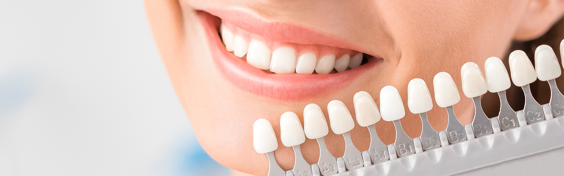 Girl with veneer model of their patient